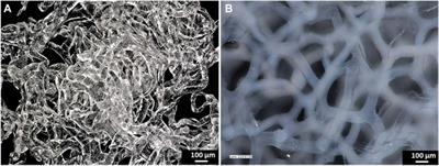 Chitin scaffolds derived from the marine demosponge Aplysina fistularis stimulate the differentiation of dental pulp stem cells